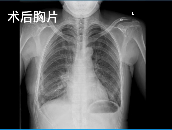 from clipboard from clipboard